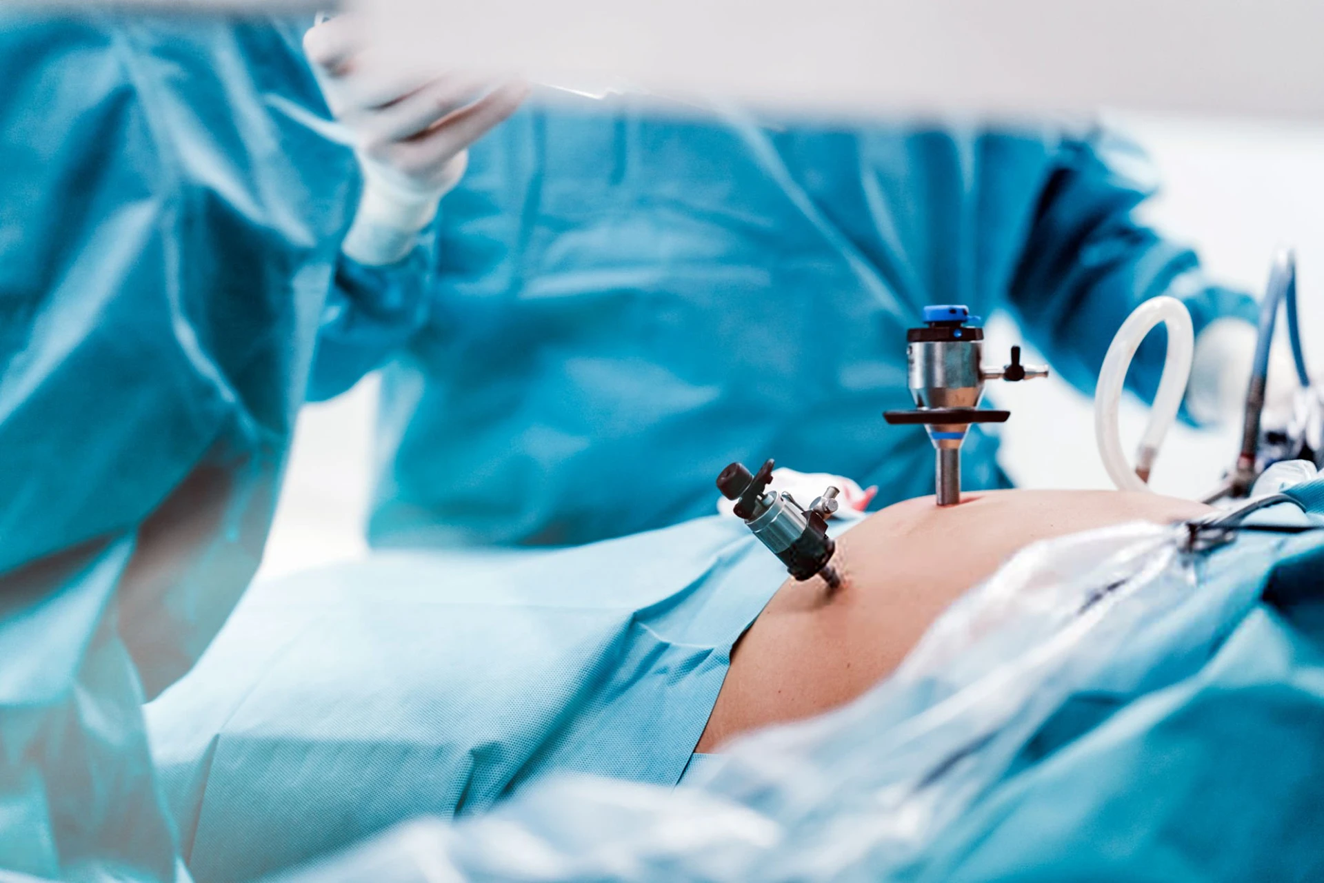 Dr Francisco Rodriguez Vega, colecistectomía laparoscópica