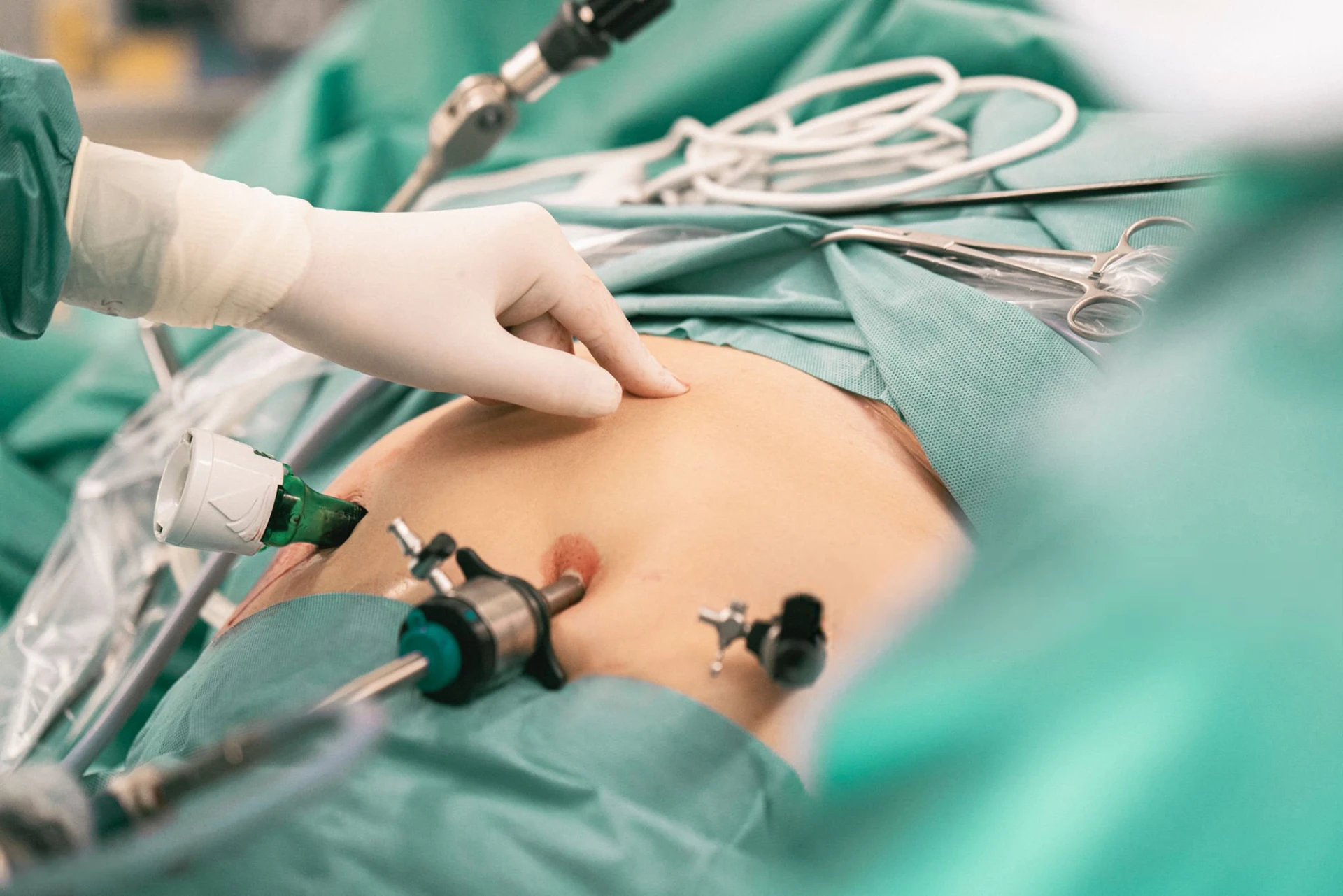 Colecistectomía laparoscópica · Dr. Francisco Rodríguez Vega