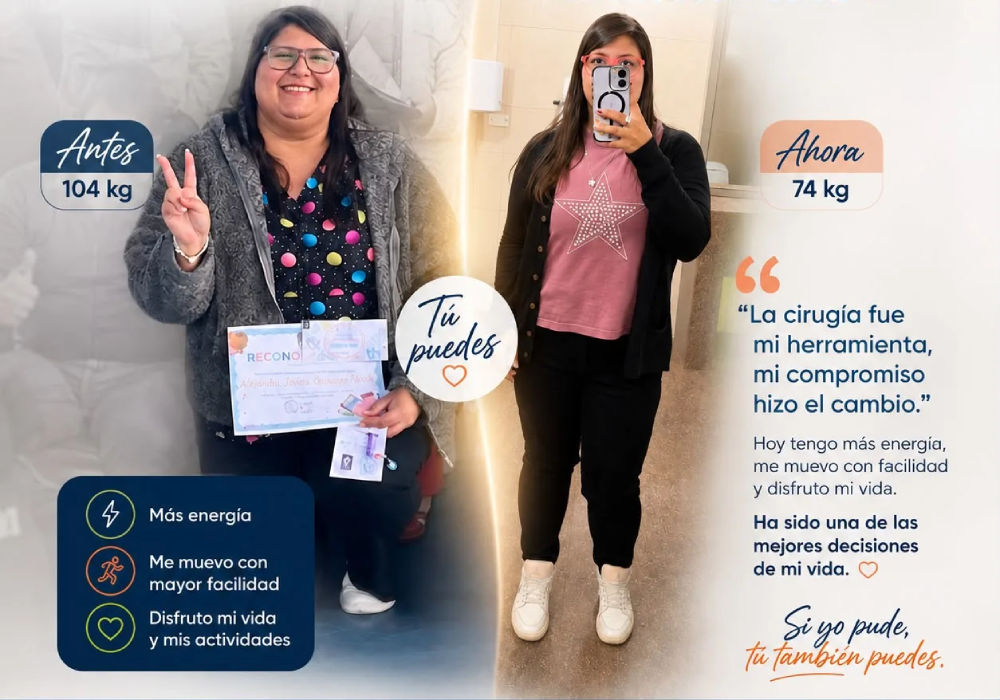 historia real de una paciente de cirugia bariátrica